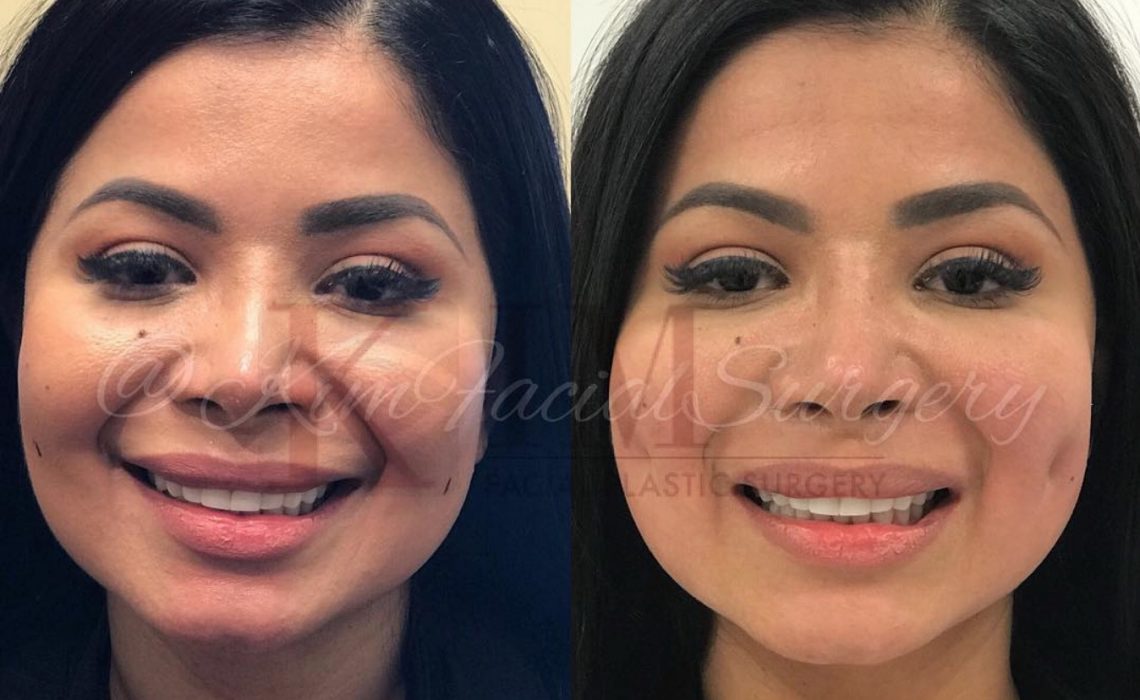 3 Weird Surgeries That Are Actually A Thing