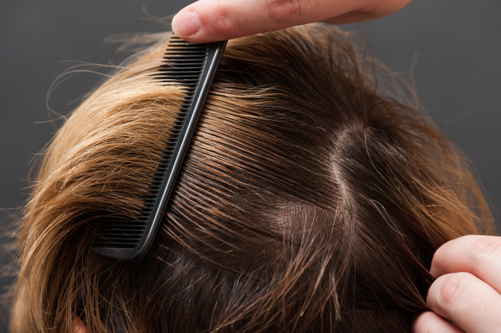 5 Things You Need To Avoid If You Don’t Want Greasy Locks