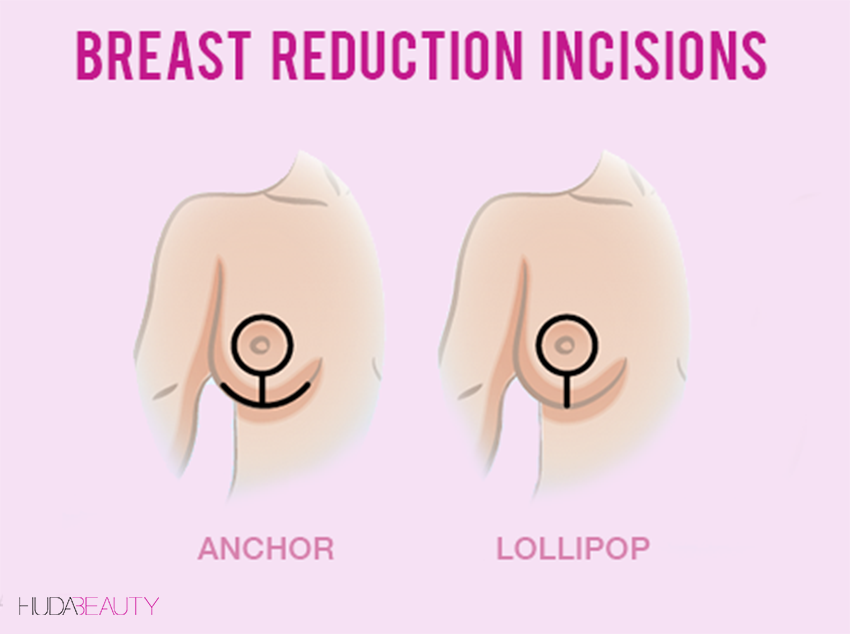 7 Things You Need To Know Before You Get A Breast Reduction Blog Huda Beauty