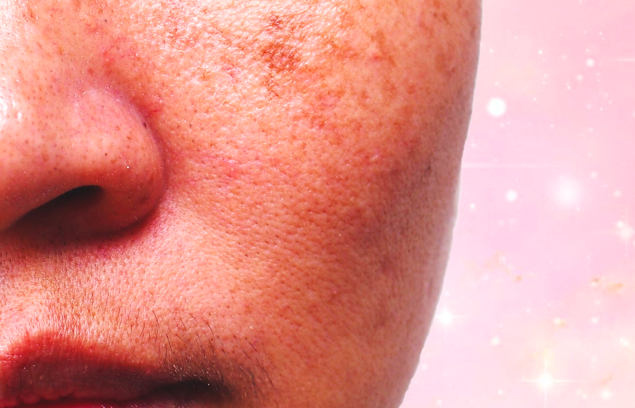 red and dark spots on face