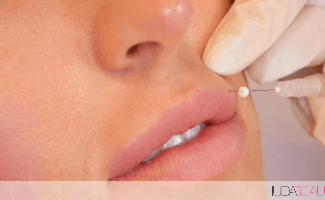 Lip Fillers, Lip Threads Are WAY Better