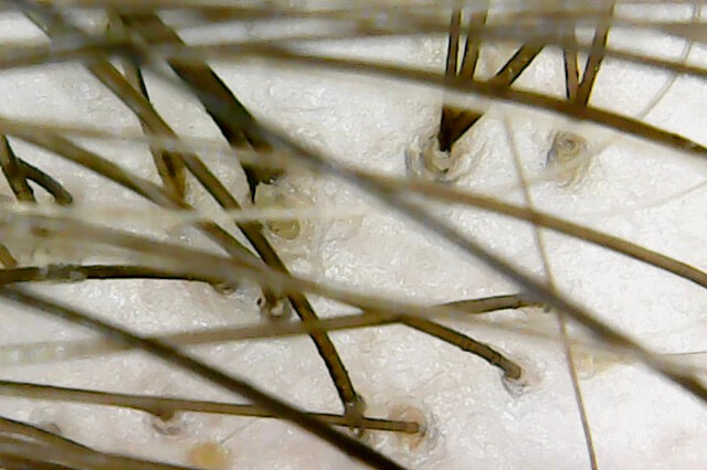 hair strand under microscope