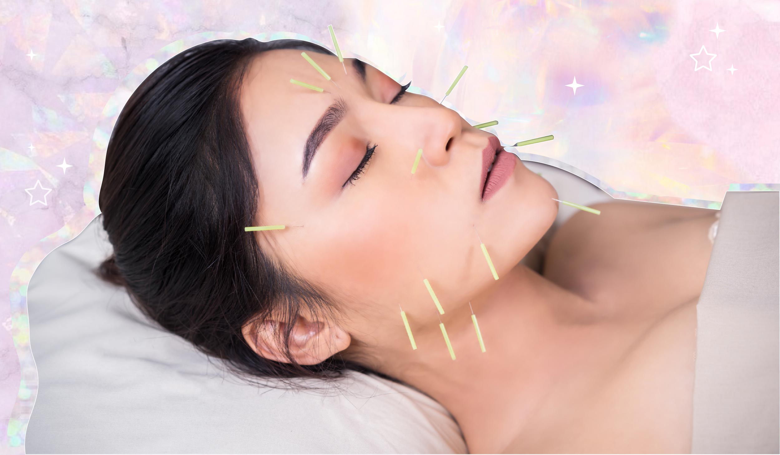 The Beauty & Health Benefits Of Acupuncture According To Experts