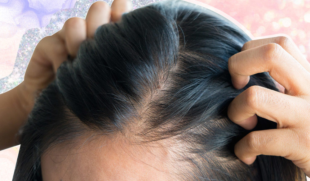 A Derm Reveals How To Fix Hormone-Related Hair Loss